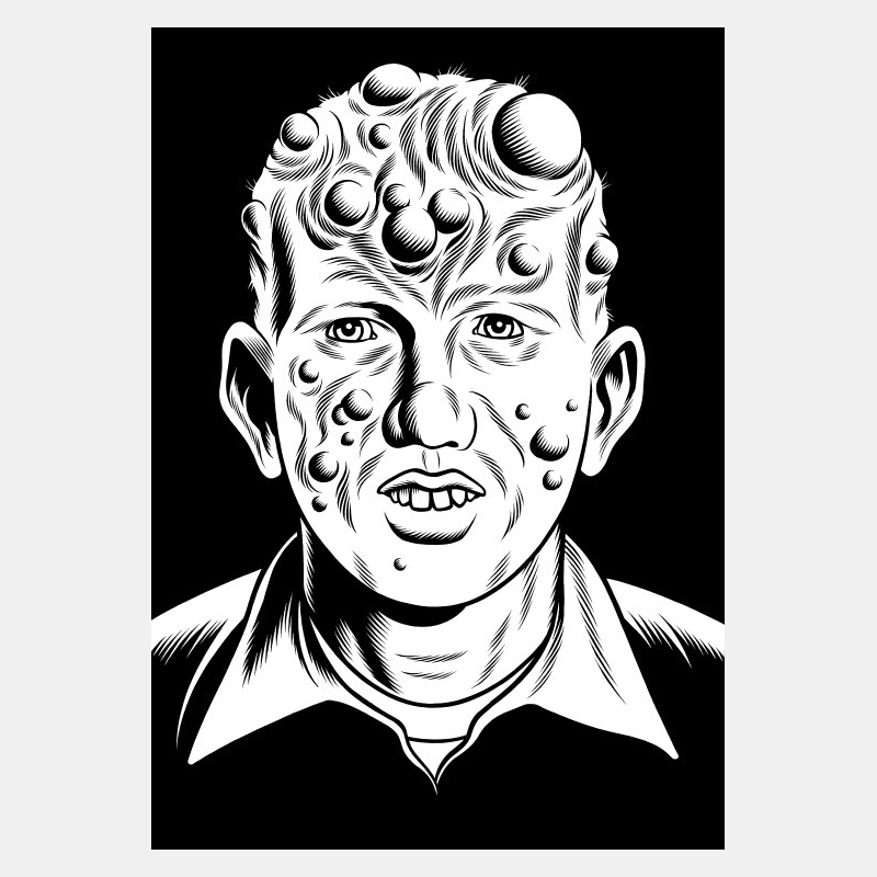 charles burns - black hole teens - 3bis charles burns - black hole teens - 3bis
